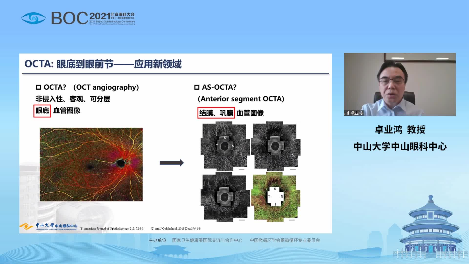 AOCT用于青光眼手术滤泡区评估