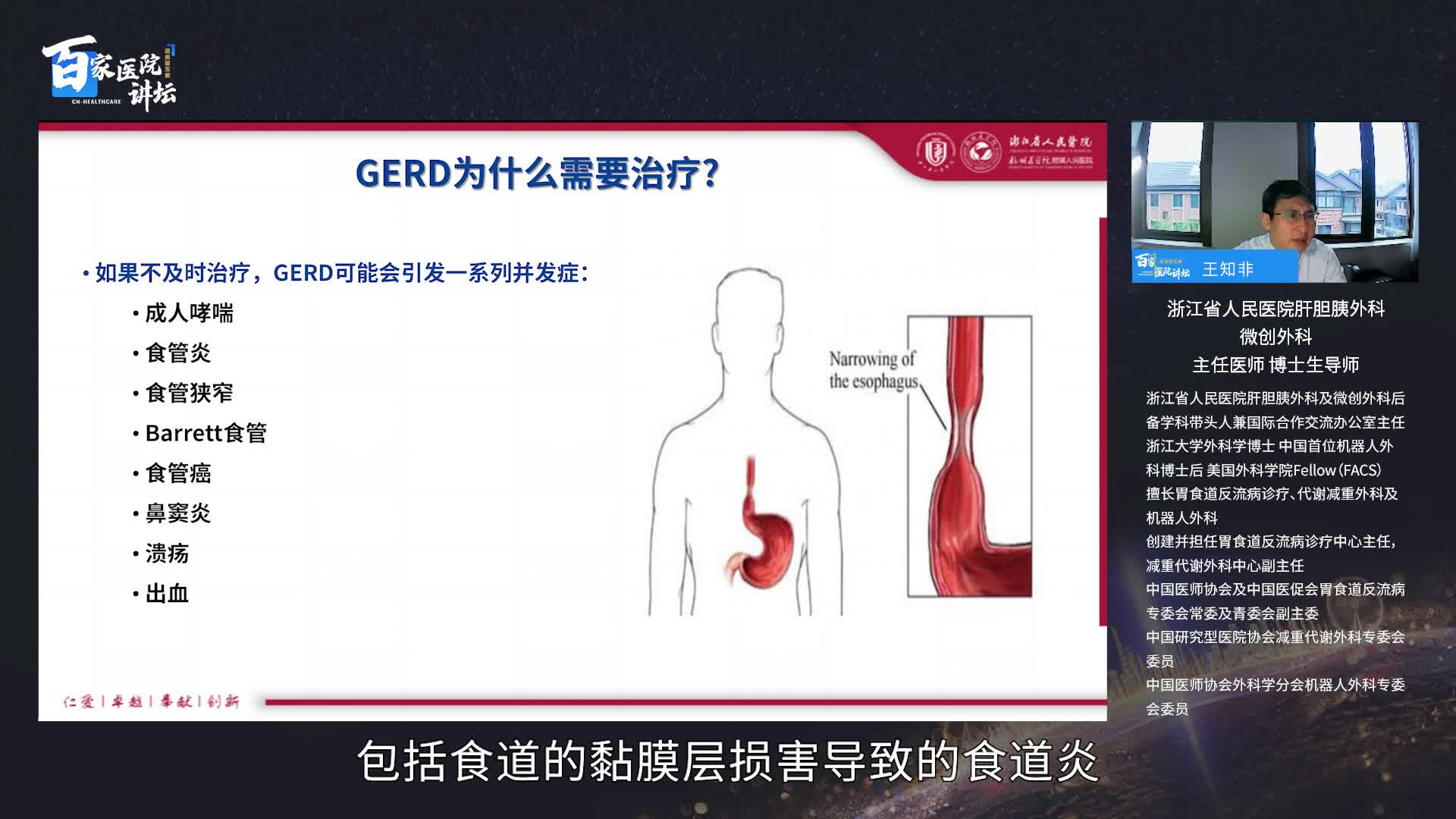 胃食管反流（GERD）的诊治要点