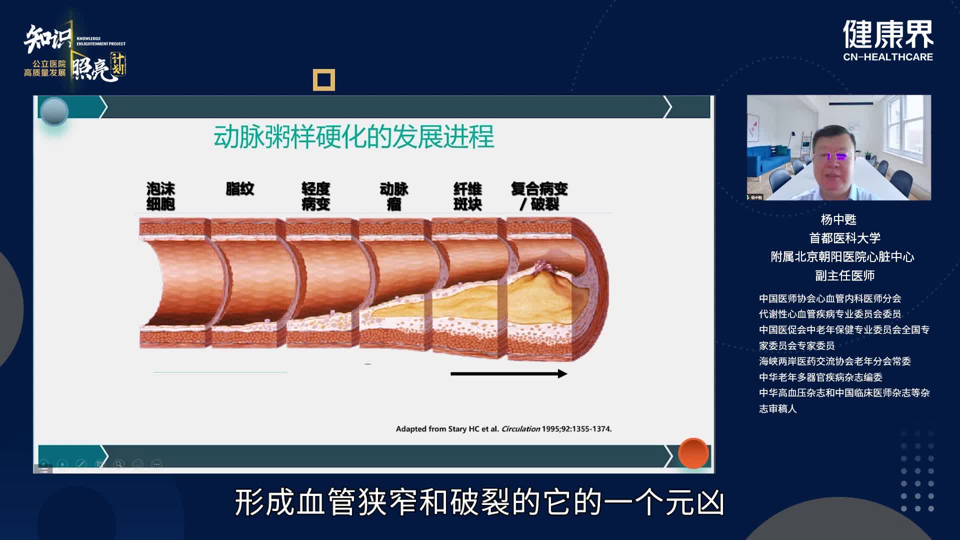 血脂异常的危险分层