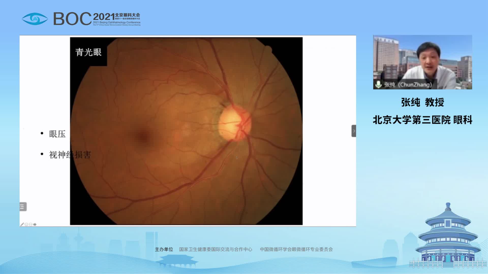 OCT技术在青光眼诊治中的应用