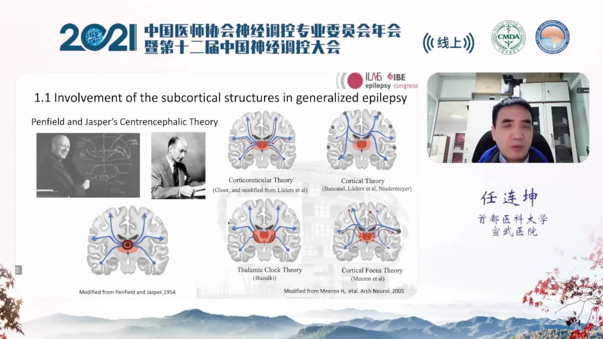 局灶性癫痫发作的皮质和皮质下网络