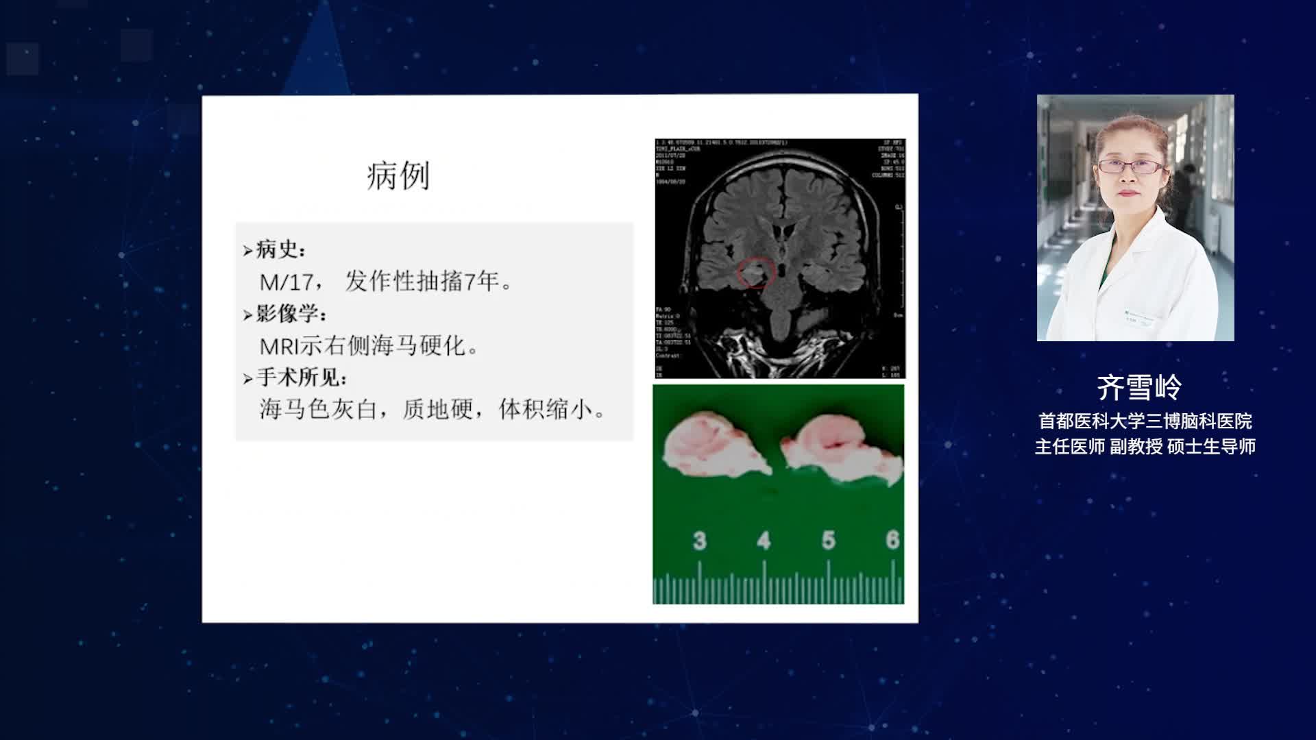 神经病理与临床联系-4