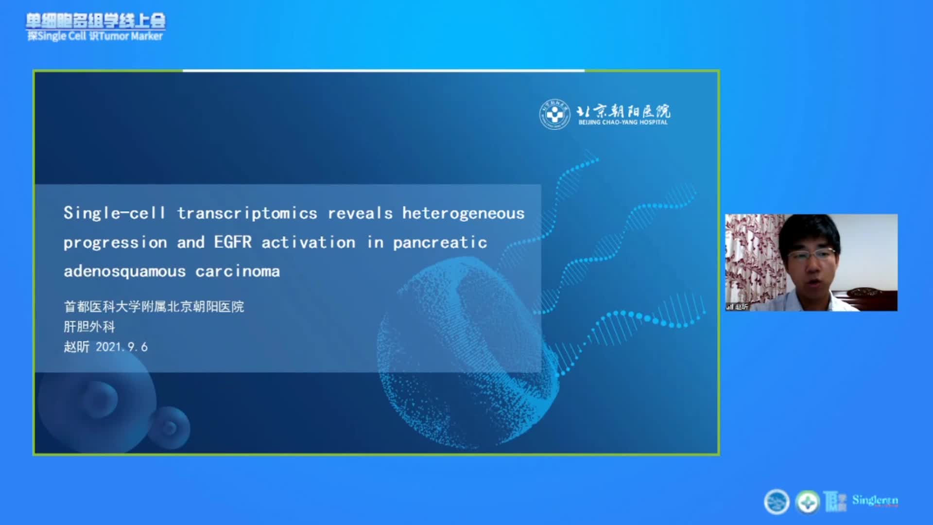 单细胞解析胰腺腺鳞癌异质性及EGFR的作用